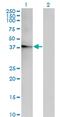 Acyl-CoA Thioesterase 7 antibody, MA5-24449, Invitrogen Antibodies, Western Blot image 