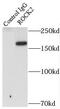 Rho Associated Coiled-Coil Containing Protein Kinase 2 antibody, FNab07378, FineTest, Immunoprecipitation image 