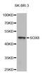 SRY-Box 8 antibody, LS-C332377, Lifespan Biosciences, Western Blot image 