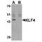 Kruppel Like Factor 4 antibody, MBS150006, MyBioSource, Western Blot image 