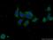 SEC24 Homolog C, COPII Coat Complex Component antibody, 16073-1-AP, Proteintech Group, Immunofluorescence image 