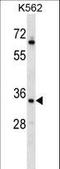 RAD1 Checkpoint DNA Exonuclease antibody, LS-C162404, Lifespan Biosciences, Western Blot image 