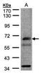 Checkpoint With Forkhead And Ring Finger Domains antibody, PA5-28079, Invitrogen Antibodies, Western Blot image 