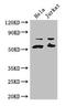 YES Proto-Oncogene 1, Src Family Tyrosine Kinase antibody, orb46191, Biorbyt, Western Blot image 