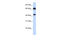 Guanylate Cyclase 1 Soluble Subunit Beta 1 antibody, 26-093, ProSci, Western Blot image 