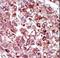 Phosphoenolpyruvate carboxylase antibody, LS-C101194, Lifespan Biosciences, Immunohistochemistry frozen image 