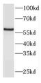 Fc Receptor Like B antibody, FNab03062, FineTest, Western Blot image 