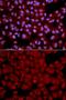 Protein Phosphatase 1 Catalytic Subunit Beta antibody, GTX32804, GeneTex, Immunocytochemistry image 