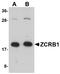 Zinc Finger CCHC-Type And RNA Binding Motif Containing 1 antibody, NBP1-76319, Novus Biologicals, Western Blot image 