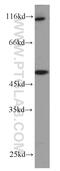 Zinc Finger Protein 3 antibody, 16950-1-AP, Proteintech Group, Western Blot image 