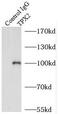 TPX2 Microtubule Nucleation Factor antibody, FNab08910, FineTest, Immunoprecipitation image 