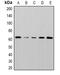 Serine/Threonine Kinase 38 antibody, orb382063, Biorbyt, Western Blot image 
