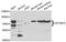UDP Glucuronosyltransferase Family 2 Member B10 antibody, STJ29707, St John