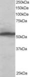 Karyopherin Subunit Alpha 2 antibody, TA302917, Origene, Western Blot image 