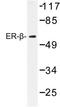 Estrogen Receptor 2 antibody, AP06806PU-N, Origene, Western Blot image 