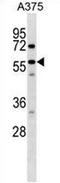 Sorting Nexin 2 antibody, AP53974PU-N, Origene, Western Blot image 