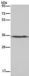 Dimethylarginine Dimethylaminohydrolase 1 antibody, PA5-50610, Invitrogen Antibodies, Western Blot image 