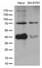 Adaptor Protein, Phosphotyrosine Interacting With PH Domain And Leucine Zipper 2 antibody, M06626, Boster Biological Technology, Western Blot image 