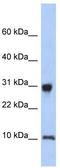 Ribosomal Protein S21 antibody, TA336064, Origene, Western Blot image 