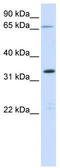 Chromosome 19 Open Reading Frame 47 antibody, TA346664, Origene, Western Blot image 