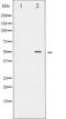 RUNX Family Transcription Factor 1 antibody, TA325834, Origene, Western Blot image 
