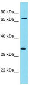 KIAA2013 antibody, TA337393, Origene, Western Blot image 