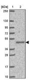 SLC44A4 antibody, NBP2-33707, Novus Biologicals, Western Blot image 