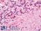 Vascular Endothelial Growth Factor D antibody, LS-C317062, Lifespan Biosciences, Immunohistochemistry paraffin image 