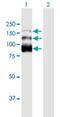 Zinc Finger CCCH-Type Containing 18 antibody, H00124245-B01P, Novus Biologicals, Western Blot image 