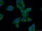 NPC Intracellular Cholesterol Transporter 1 antibody, 13926-1-AP, Proteintech Group, Immunofluorescence image 