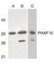 Acidic Nuclear Phosphoprotein 32 Family Member E antibody, PA5-20023, Invitrogen Antibodies, Western Blot image 