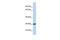 Zinc Finger CCHC-Type Containing 24 antibody, GTX45246, GeneTex, Western Blot image 