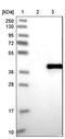 Monoglyceride Lipase antibody, PA5-52891, Invitrogen Antibodies, Western Blot image 
