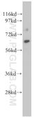 Cerebellar degeneration-related protein 2-like antibody, 14563-1-AP, Proteintech Group, Western Blot image 