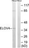ELOVL Fatty Acid Elongase 4 antibody, TA314576, Origene, Western Blot image 