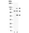 Proprotein Convertase Subtilisin/Kexin Type 6 antibody, R32047, NSJ Bioreagents, Western Blot image 