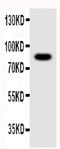 Nlrp4g antibody, LS-C312838, Lifespan Biosciences, Western Blot image 