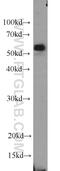 Spastin antibody, 22792-1-AP, Proteintech Group, Western Blot image 