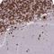 DEAD-Box Helicase 1 antibody, NBP1-85294, Novus Biologicals, Immunohistochemistry frozen image 