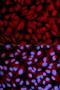 CASK antibody, orb167165, Biorbyt, Immunofluorescence image 
