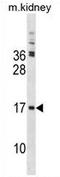 TSC22 Domain Family Member 3 antibody, AP54370PU-N, Origene, Western Blot image 