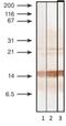 Calcitonin Related Polypeptide Alpha antibody, GTX14816, GeneTex, Western Blot image 