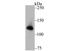 UPF1 RNA Helicase And ATPase antibody, NBP2-76842, Novus Biologicals, Western Blot image 