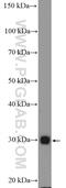 HLA class II histocompatibility antigen, DM beta chain antibody, 21704-1-AP, Proteintech Group, Western Blot image 