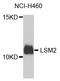 LSM2 Homolog, U6 Small Nuclear RNA And MRNA Degradation Associated antibody, A07586-1, Boster Biological Technology, Western Blot image 