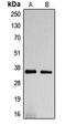 DnaJ Heat Shock Protein Family (Hsp40) Member C17 antibody, LS-C353473, Lifespan Biosciences, Western Blot image 