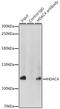 Histone Deacetylase 4 antibody, LS-C330857, Lifespan Biosciences, Immunoprecipitation image 