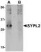 Synaptophysin-like protein 2 antibody, NBP1-77362, Novus Biologicals, Western Blot image 