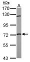Fragile X mental retardation syndrome-related protein 1 antibody, NBP1-33719, Novus Biologicals, Western Blot image 