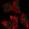 N-Acetyltransferase 16 (Putative) antibody, NBP1-93791, Novus Biologicals, Immunocytochemistry image 